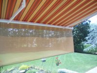 striped retractable sunscreen